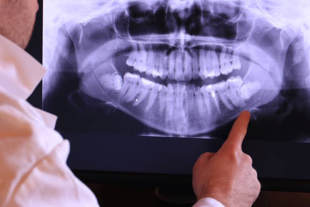 Best Tooth Infection Emergency Dentist  in Mcfarland, CA