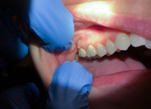 Best Cracked Tooth Emergency Dentist  in Mcfarland, CA