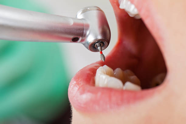 Best Emergency Dentist Open Today  in Mcfarland, CA